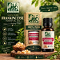 BioShop 100% Pure Frankincense Essential Oil (Boswellia Serrata) - 30ml
